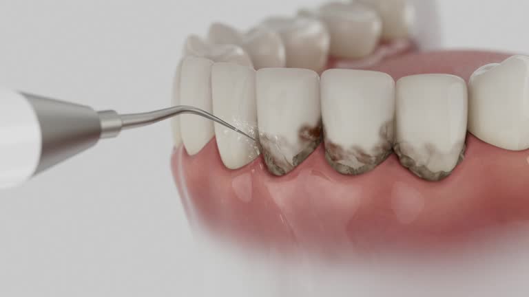 Trusted Teeth Cleaning And Checkup service in Willard, MO - Dentist Open Now